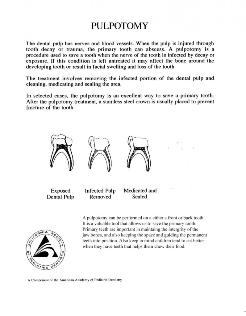 before pulpotomy homecare instructions
