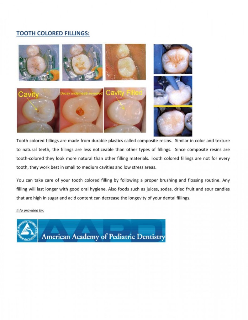 before white or resin fillings homecare instructions