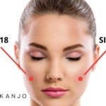 Woman’s face showing bilateral SI 18 (Kanjo) points near the outer corners of the eyes, marked with red dots and labeled “SI 18” and “KANJO.”